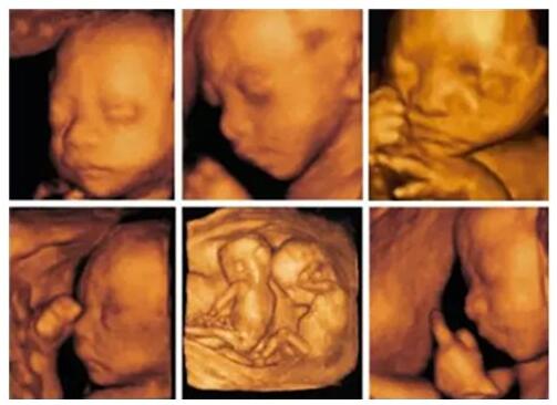 这么酷炫的四维视频，让你分分钟变身朋友圈的网红宝宝~